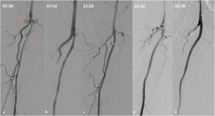 Fig. 2