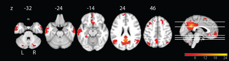 Fig.2