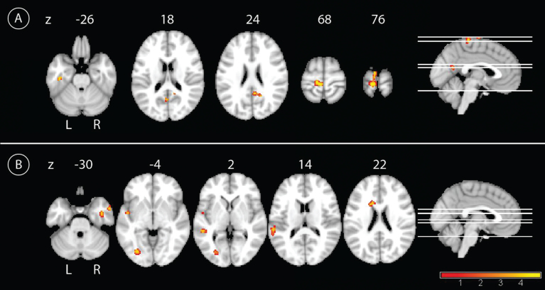 Fig.3