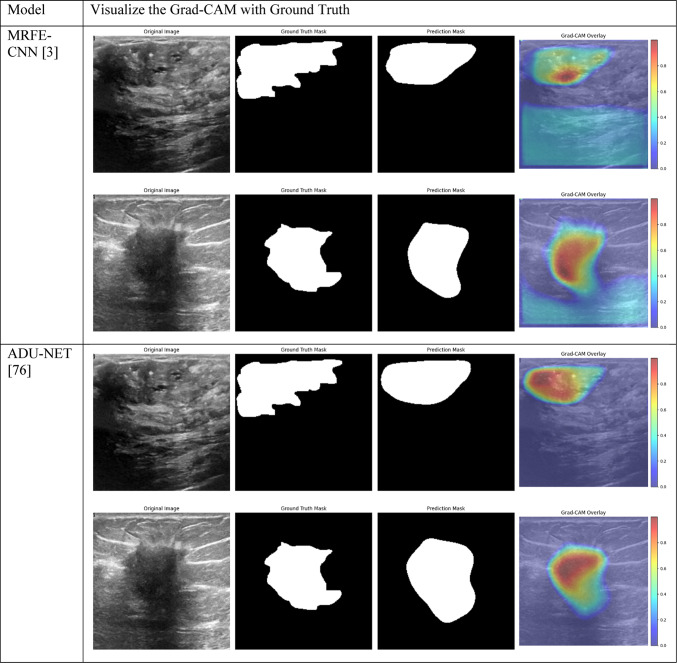 graphic file with name 41598_2024_84504_Tab6a_HTML.jpg