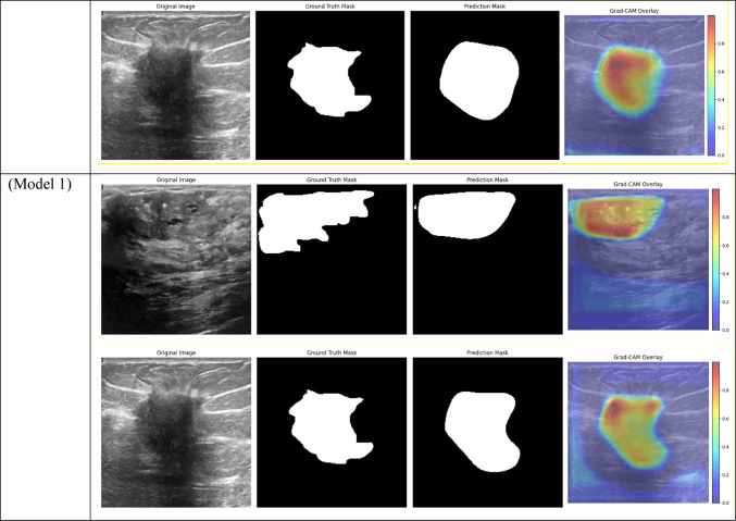 graphic file with name 41598_2024_84504_Tab6c_HTML.jpg