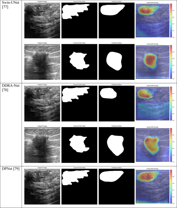 graphic file with name 41598_2024_84504_Tab6b_HTML.jpg