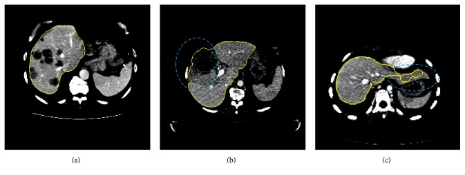 Figure 9