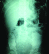 FIG. 2.