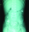 FIG. 1.
