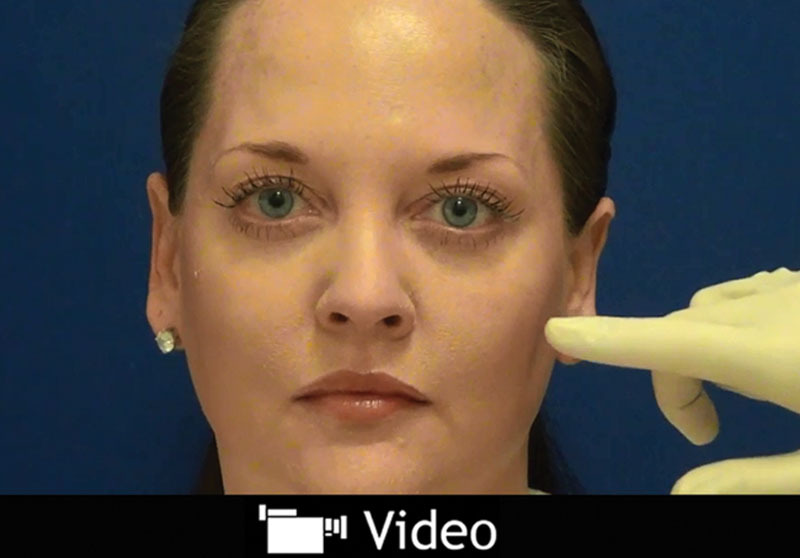 Video Graphic 1.