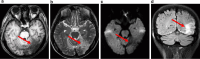 Fig. 3