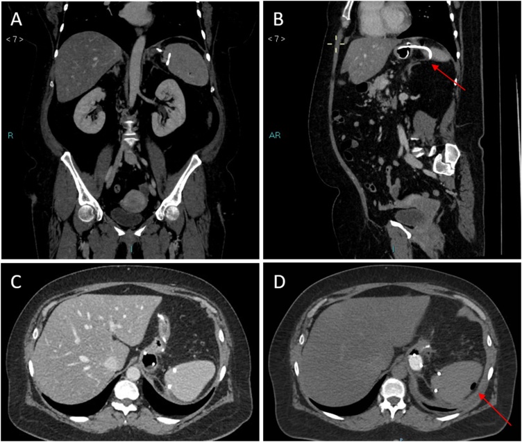 Fig. 2