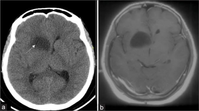 Figure 3: