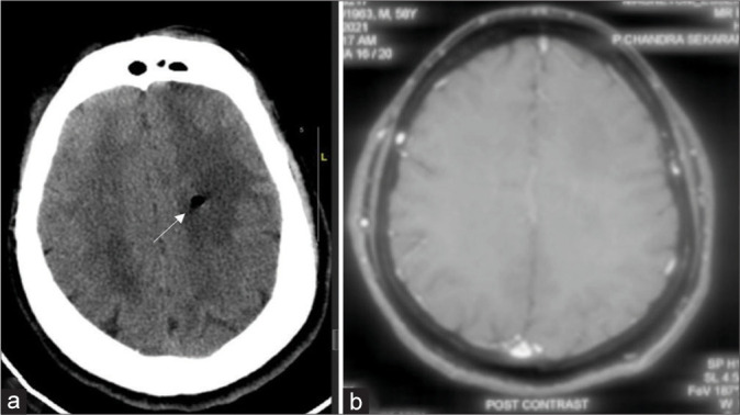 Figure 4: