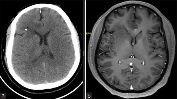 Figure 2: