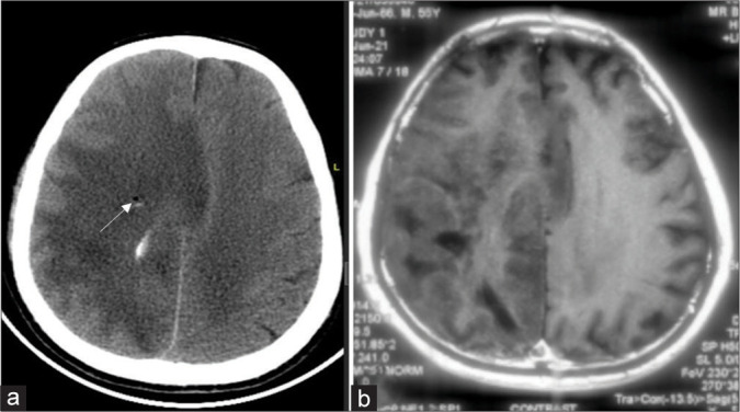 Figure 1: