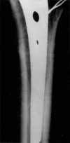 Fig. 16