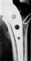Fig. 9