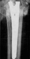 Fig. 18