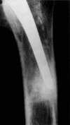 Fig. 13