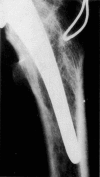 Fig. 12