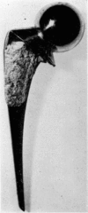 Fig. 14