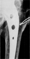 Fig. 11
