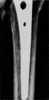 Fig. 17