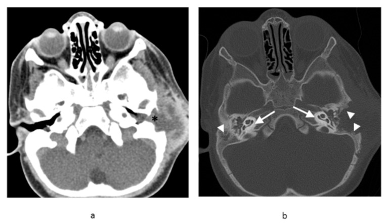 Fig. (2)