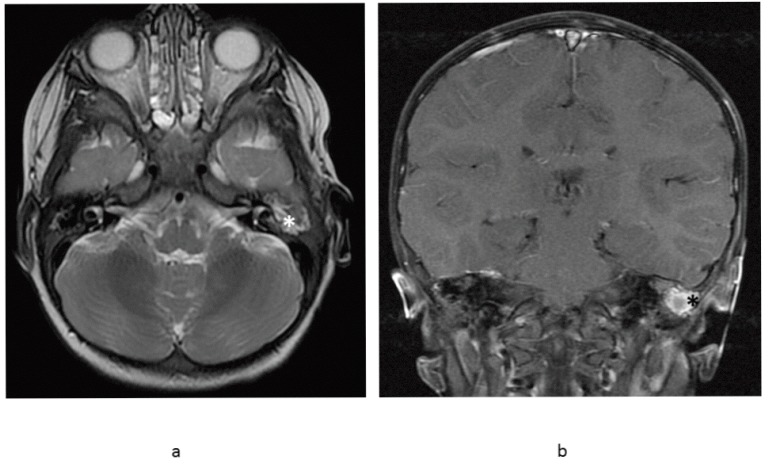 Fig. (5)