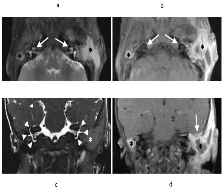 Fig. (3)