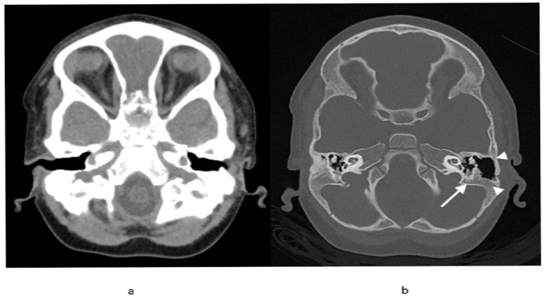 Fig. (4)