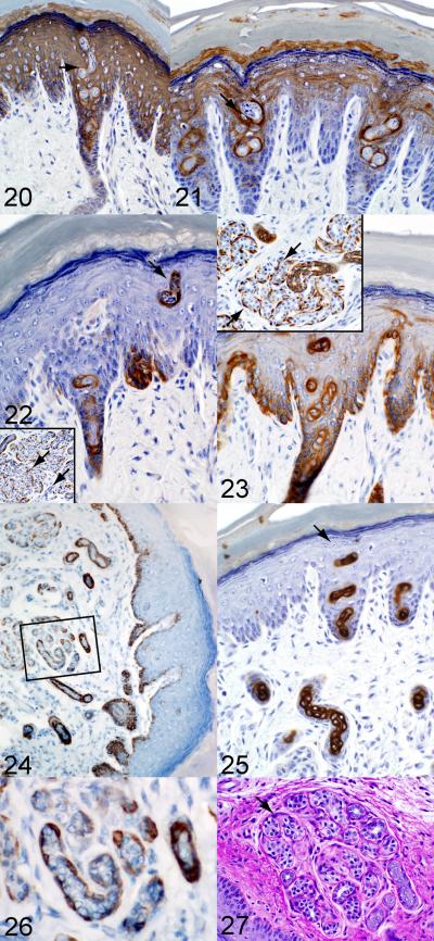 Fig. 20