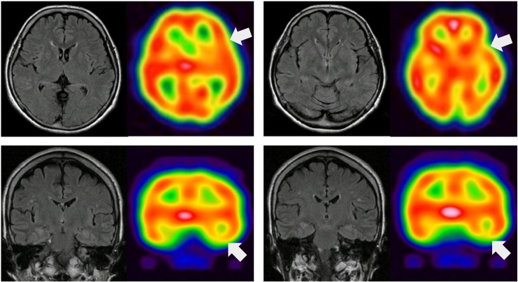 Fig. 1