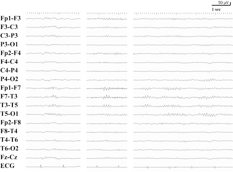 Fig. 2