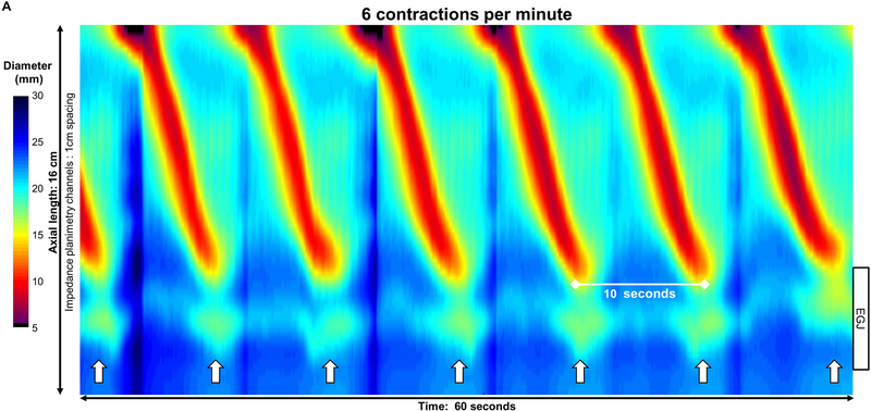 Figure 2: