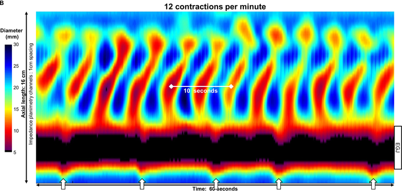 Figure 2: