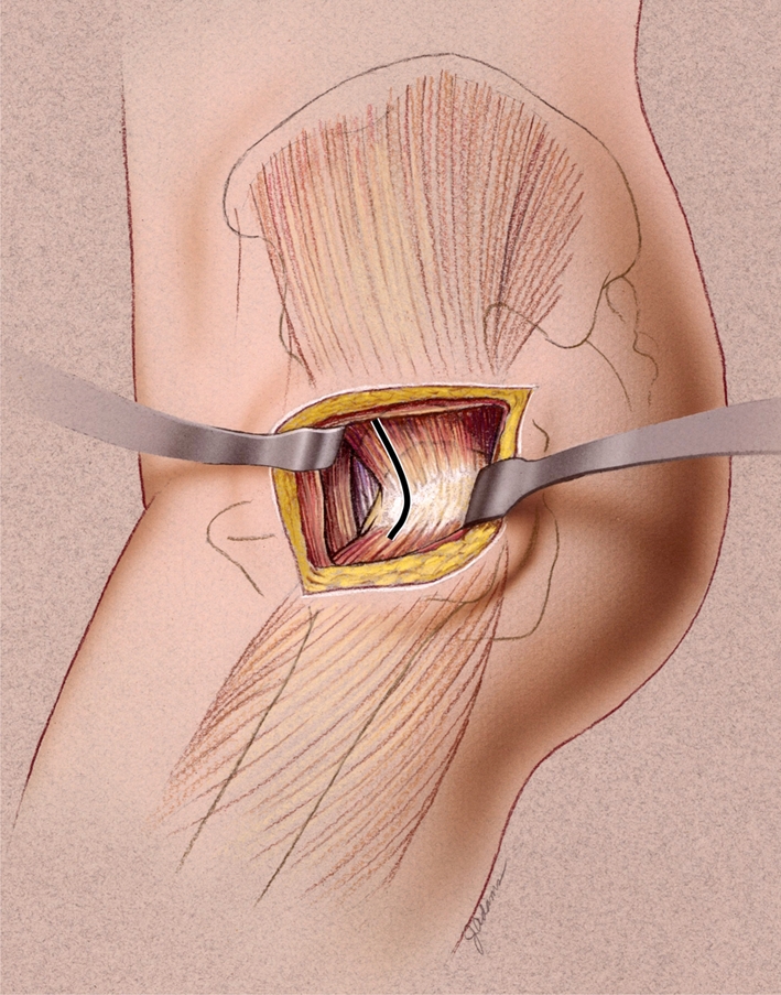 Fig. 3