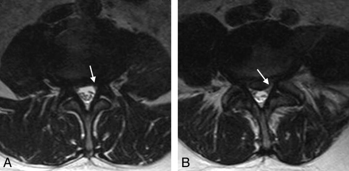 Fig 3.