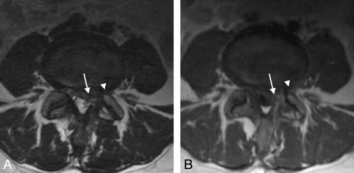 Fig 2.