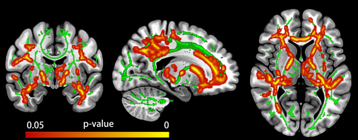 FIGURE 3