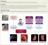 Structured Graphical Abstract