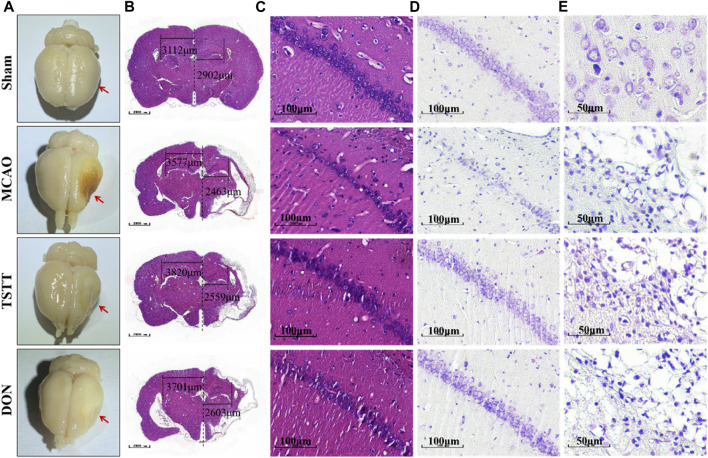 FIGURE 3