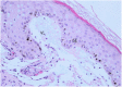 Figure 11.