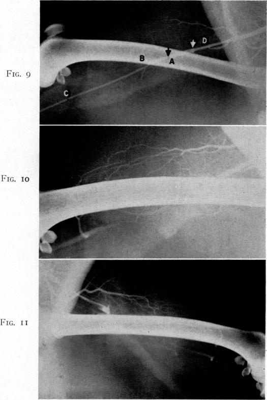 Fig. 9., Fig. 10., Fig. 11.