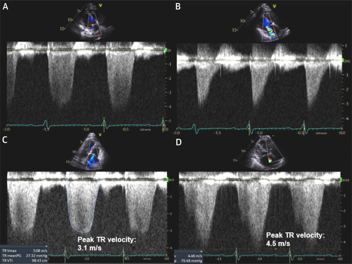 Figure 2