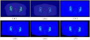 Fig 11