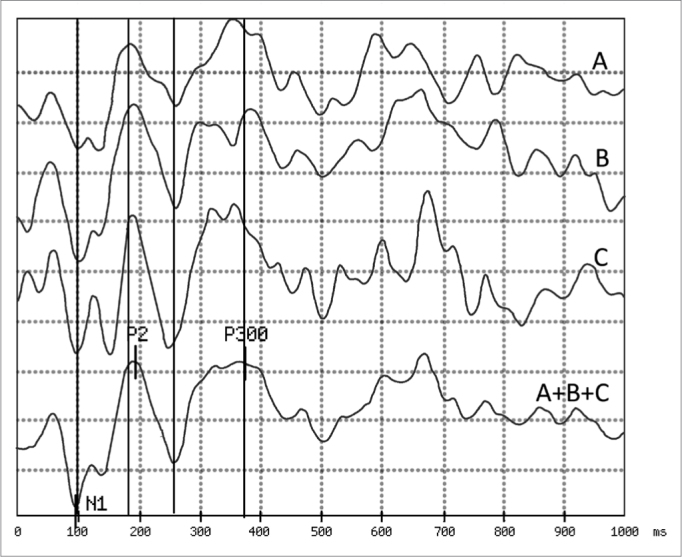 Figure 2