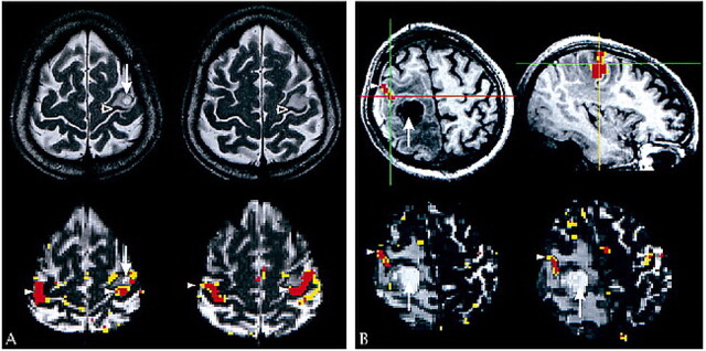 fig 1.