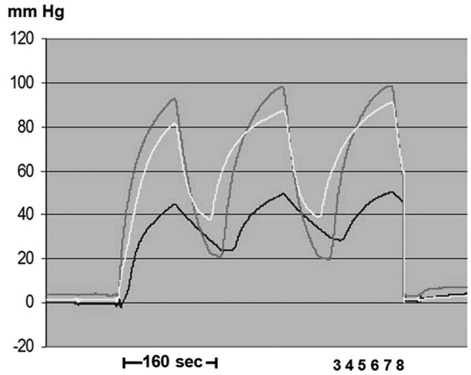 FIG. 3.