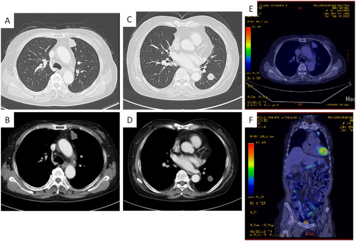 Fig. 1