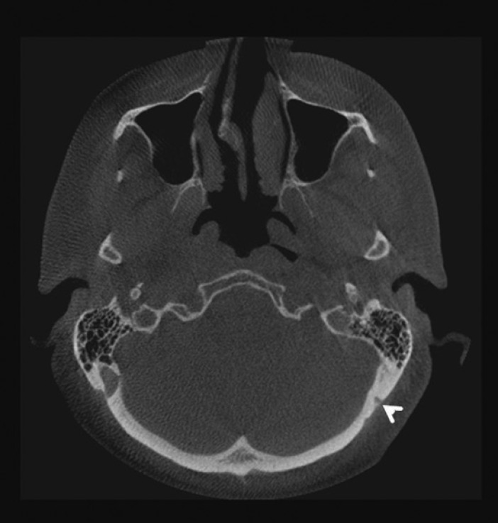 Fig. 5