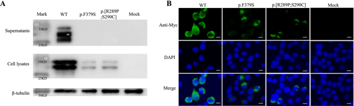 FIGURE 4