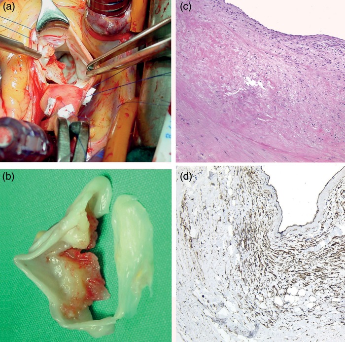 Figure 2: